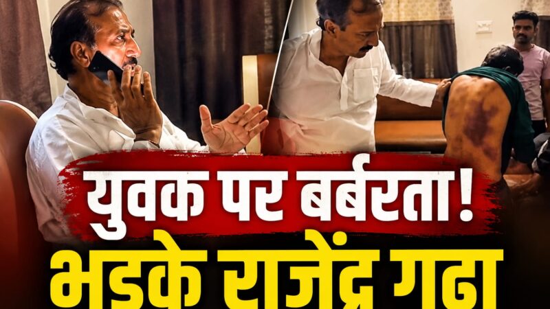 युवक की पीठ पर पिटाई के निशान! फिर पूर्व मंत्री भड़के एसपी पर